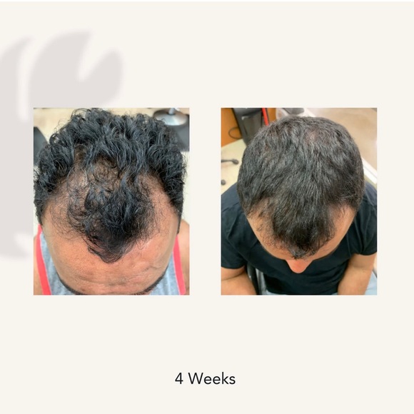 THICKENING CONDITIONER - Picture 5 of 6